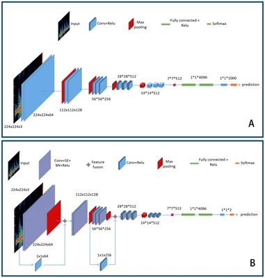 Identification of middle cerebral artery stenosis in transcranial Doppler using a modified VGG-16